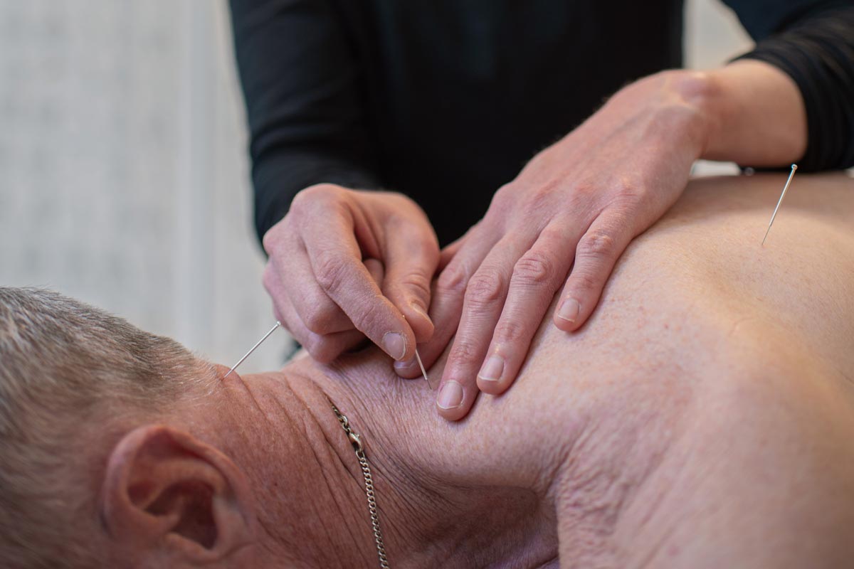 Utförande av akupunktur på en kund i Uppsala